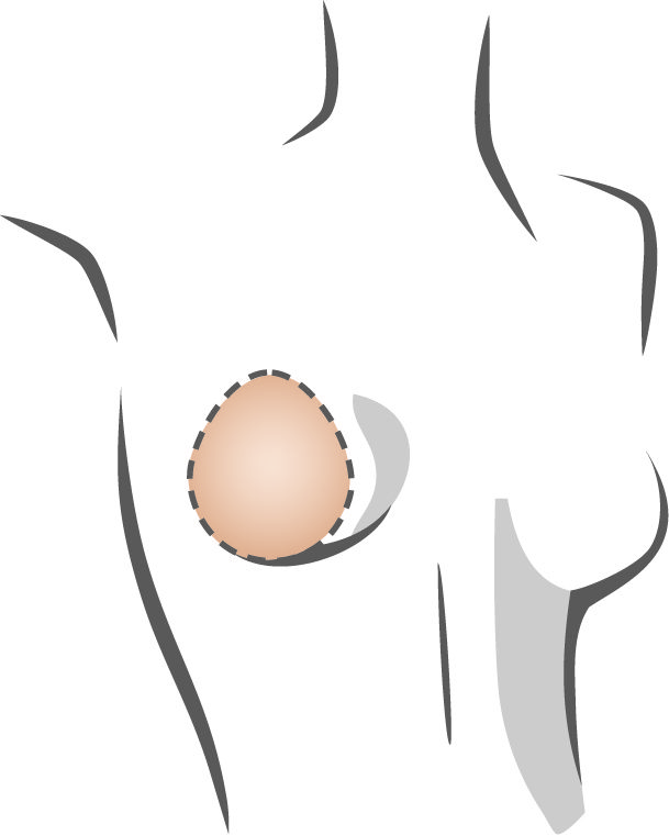 Amoena Balance Shaper Thin Oval 228 - Image 4